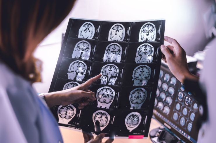 neurosurgery